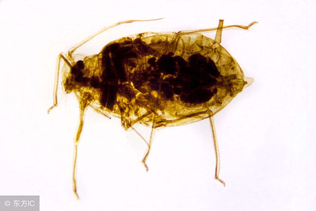 竟然有人身上会有虱子？