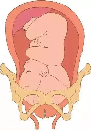 子宫脱垂小便出血严重吗,子宫脱垂与白带多有关吗