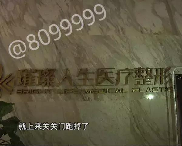 女子植发然后全部脱发,女子斑秃治疗后全秃