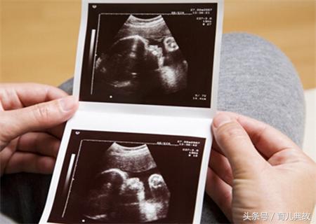 胎儿b超未见胆囊怎么进一步确诊,孕28周胎儿心脏彩超没做