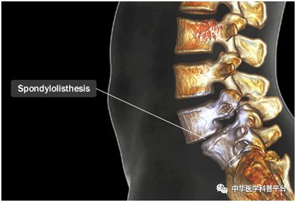 腰背部疼痛什么原因引起的,腰上背部疼痛是什么原因