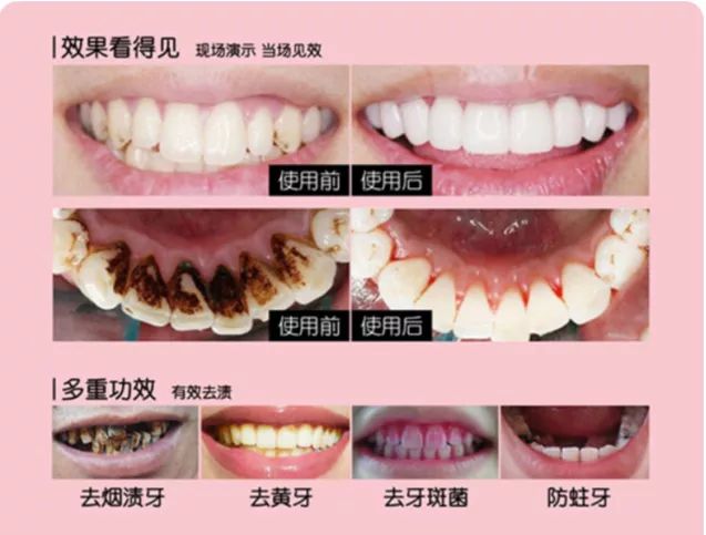 闭着嘴巴都感觉口腔有异味,闭着嘴巴嘴巴里有一股臭味