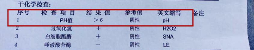 看懂孕检b超单,如何看懂孕检单