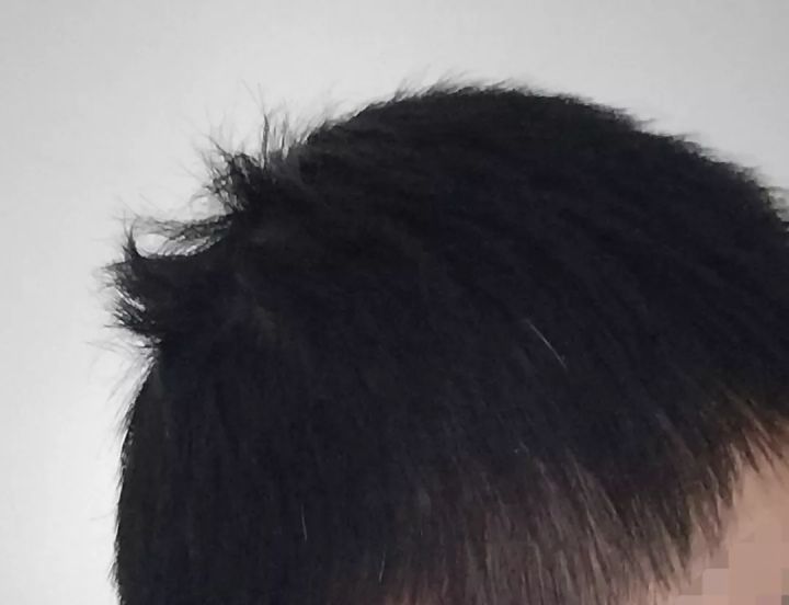 睡觉头发乱得像鸡窝一样,睡觉醒来头发乱