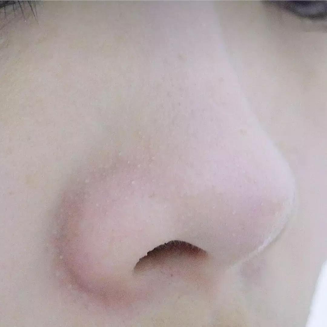 这个夏季不要染的发色,不要粗毛孔赶走草莓鼻