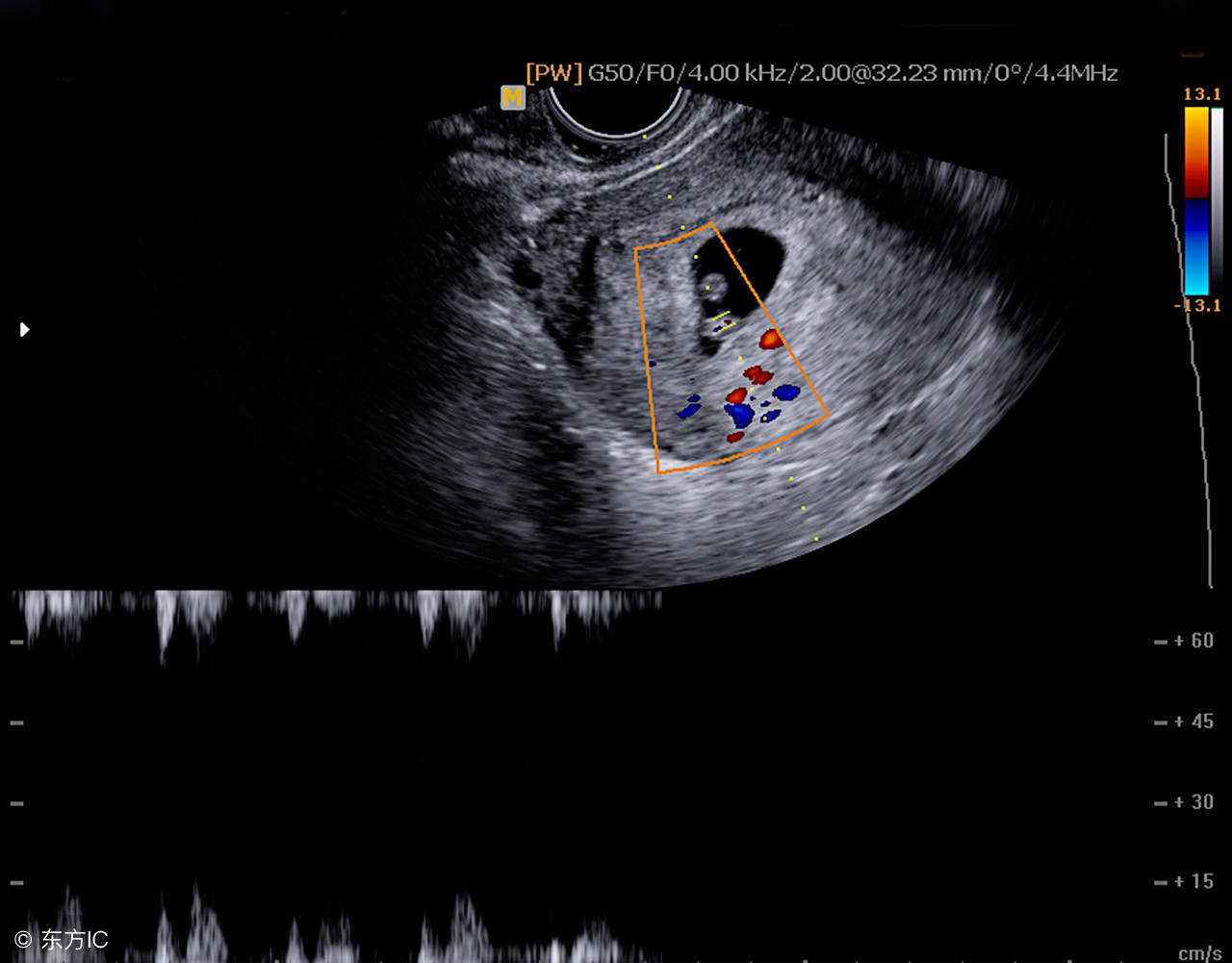 37周胎儿b超数据对照表,怀孕1-40周b超对照表