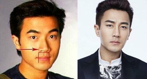 天津整形医院哪家是正规医院,整形医院最有口碑是哪几家