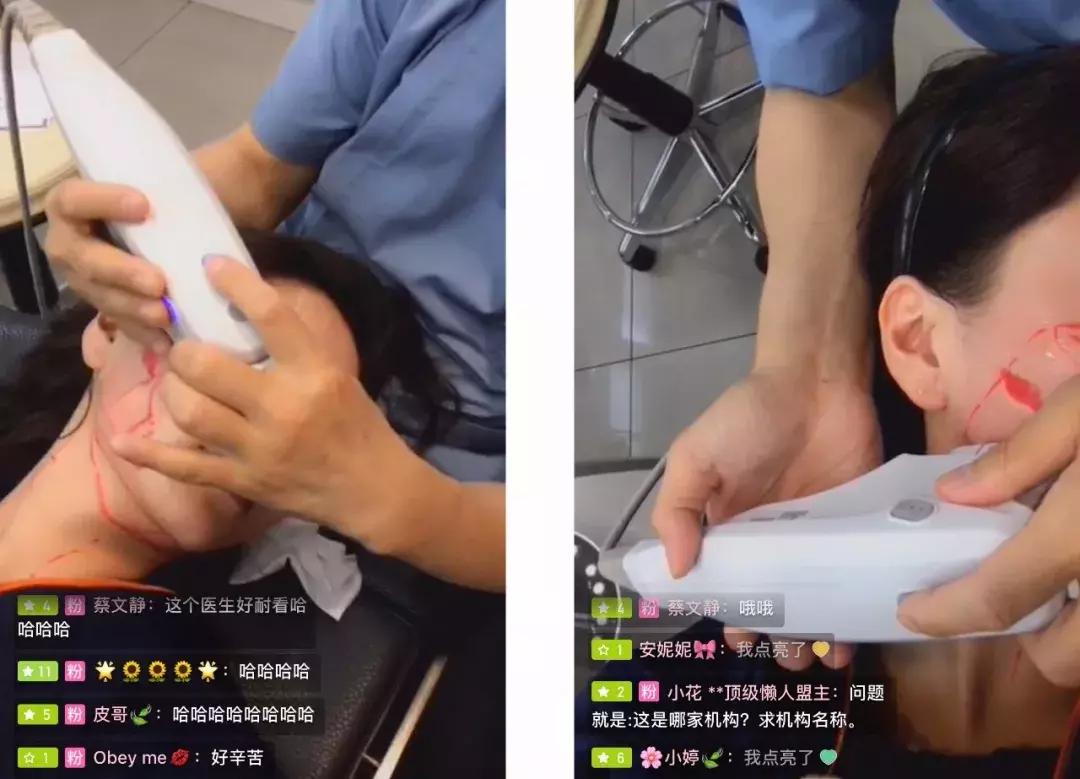 几千块钱做的超声刀，想要逆龄反被毁容？！