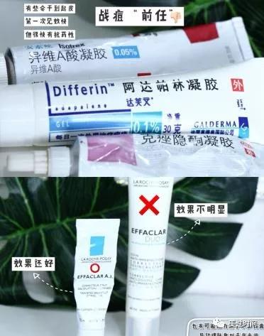 “战痘”前任与现任