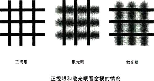 学校给孩子体检的视力散光准确吗,幼儿园体检发现近视或散光怎么办