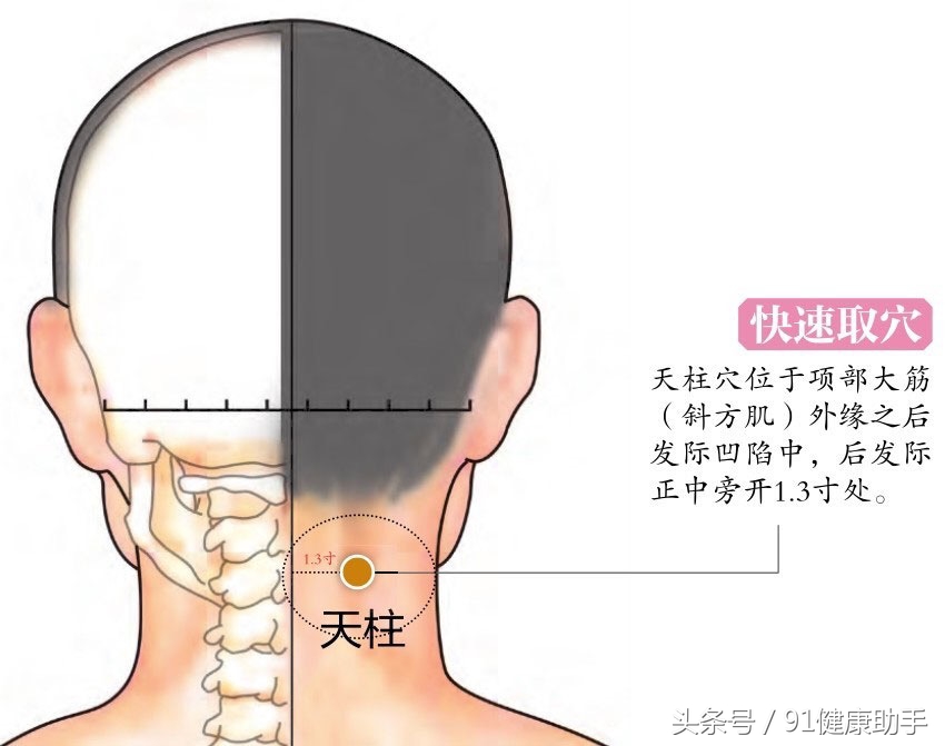穴位治疗头痛视频,天柱穴能缓解头晕吗