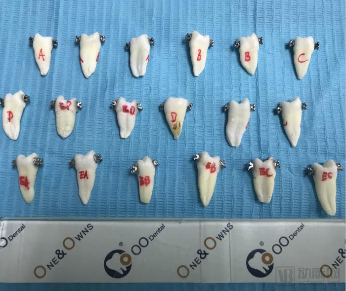 牙科医生或牙科诊所转让,牙科医生卖牙套