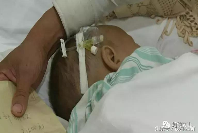 八月大孩子被亲娘挥刀割掉*体下**，文山州医院医生自发捐款出手相助