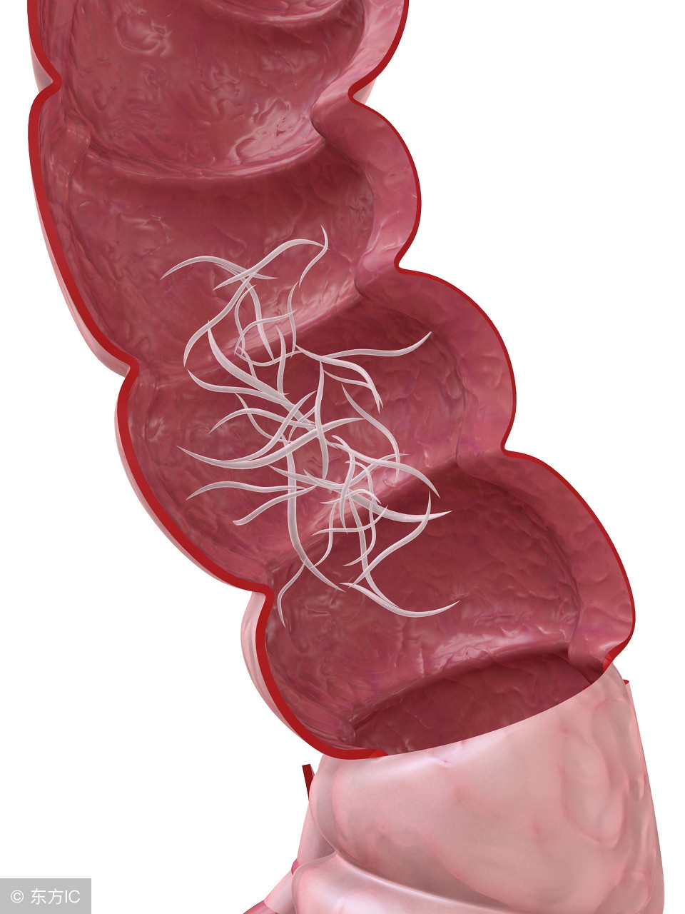 小女孩隐*处私**掉虫子？这个问题不少见