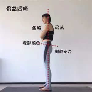 腰腿疼竟是骨盆惹的祸,骨盆前倾造成腰腿痛怎么解决