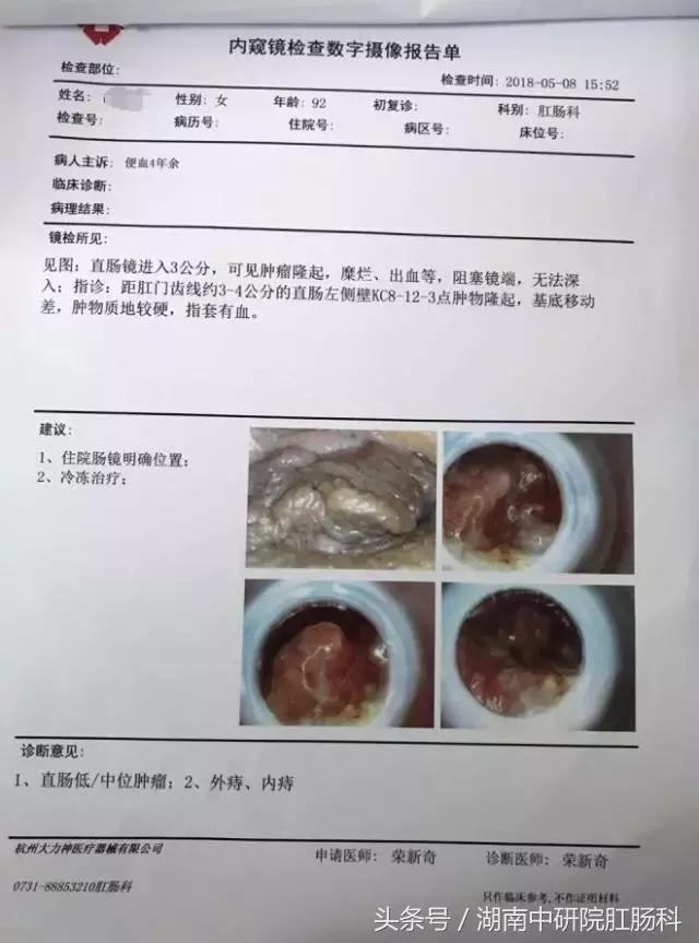 直肠癌康复视频,直肠癌患者术后的护理个案报告