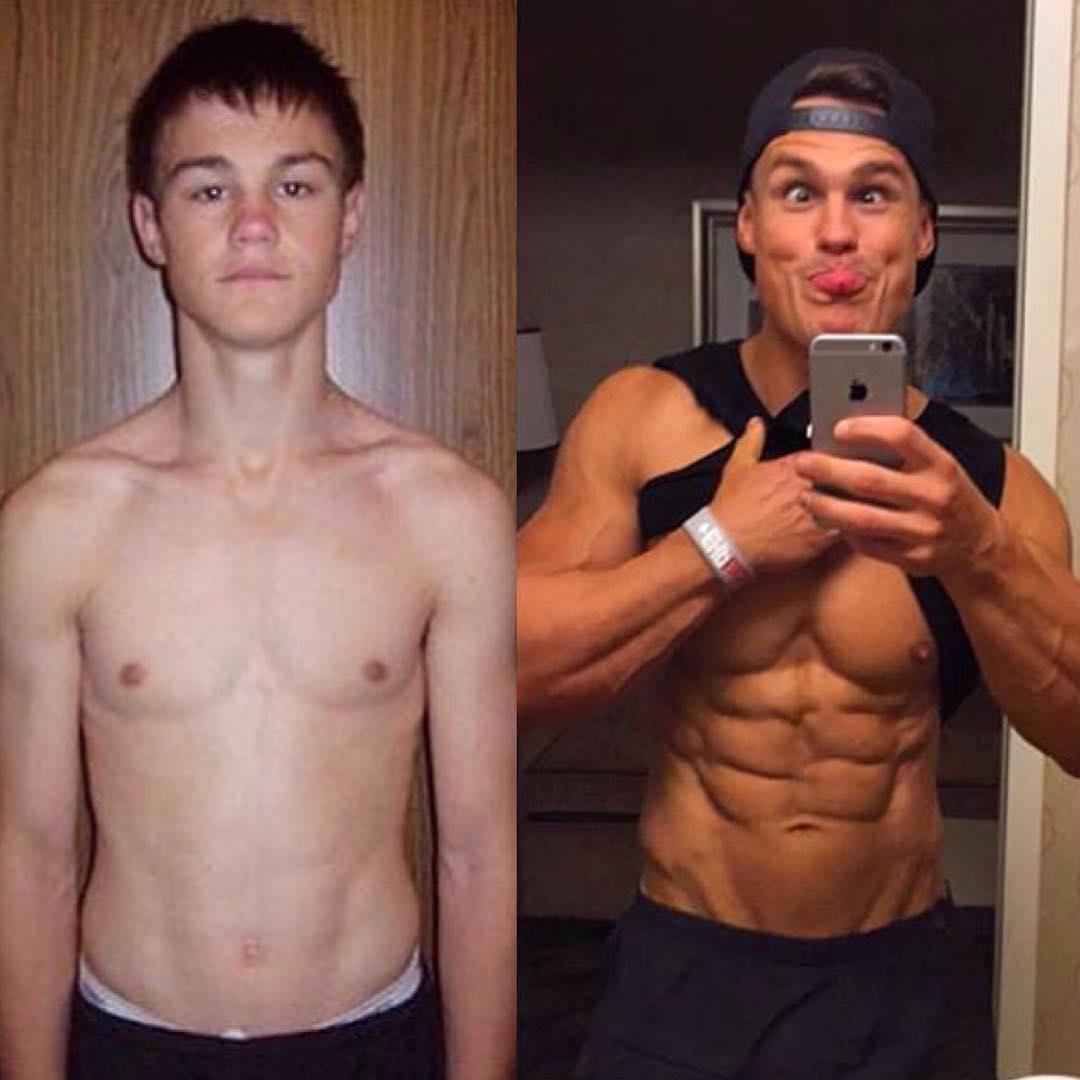 激痛点是筋膜炎吗,肌肉痉挛硬结怎么消除