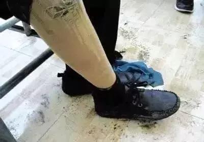 可笑又可怕，为了运毒，他们连小丁丁都不放过