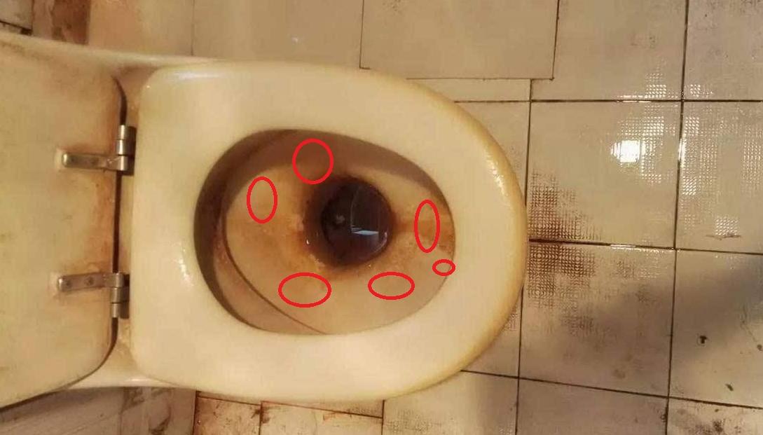 马桶又脏又臭滋生细菌,马桶又黄又有水污怎么办