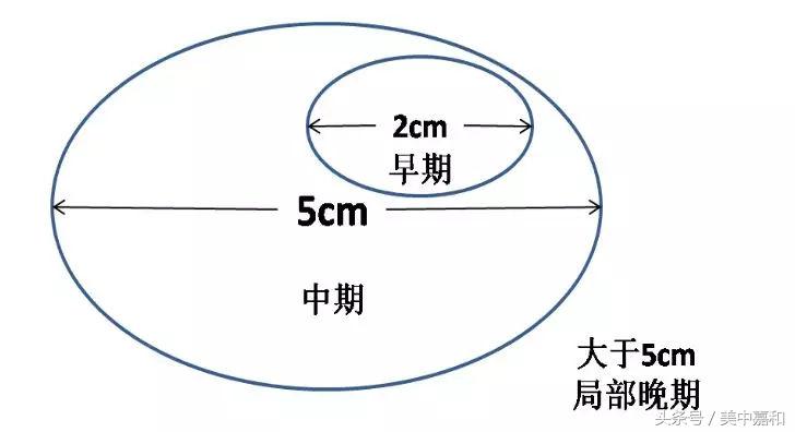 乳腺癌病理报告单的符号有哪些,301医院乳腺癌病理报告单