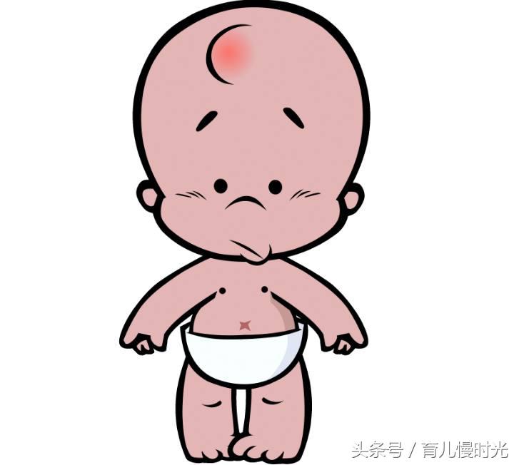 孩子摔倒碰到头后需要关注什么,小孩子摔倒头部起包怎么处理