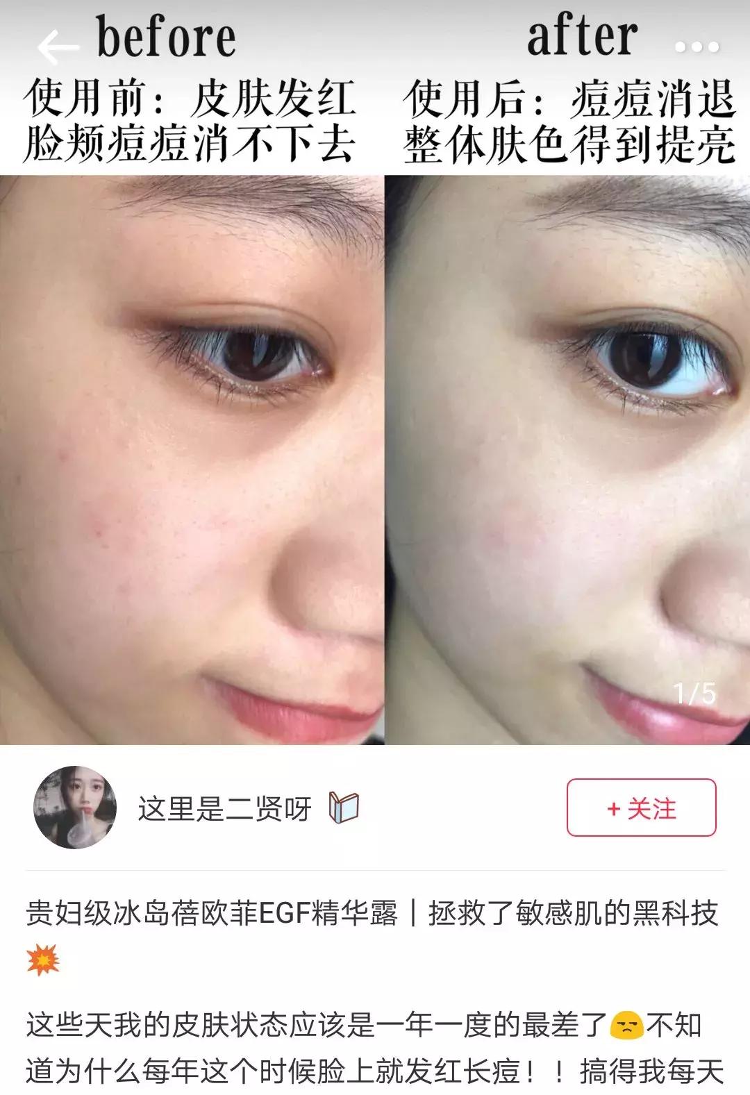 冰岛有啥值得买的东西,冰岛有哪些值得购买的东西