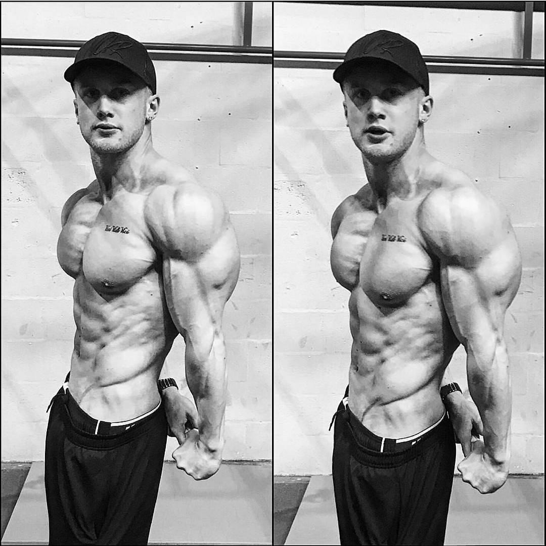 肩膀都过度内旋了，这是怎么造成的呢？别纠结了，赶紧矫正