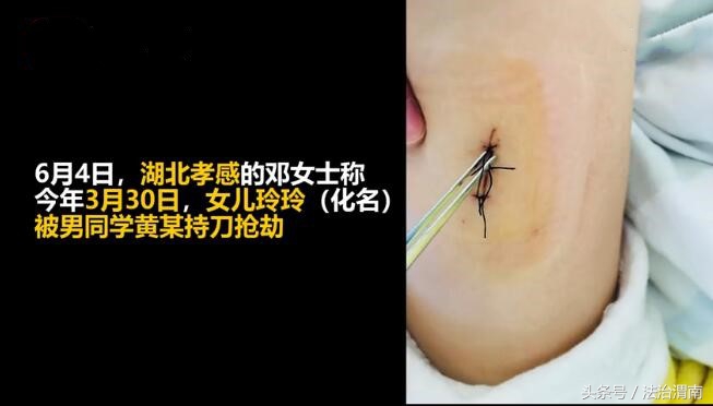 孩子持刀砍人警方怎么处理,13岁男孩刺伤女孩被判