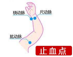 手指割破了能用嘴吗,手指被割了一个口子会愈合吗