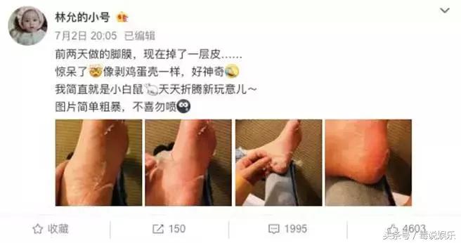 林允回应被黑事件,林允回应撕脚皮视频