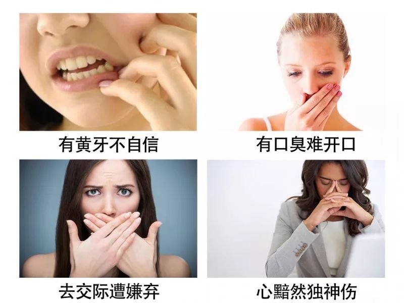 口腔强效除味剂,口腔抑制剂除异味