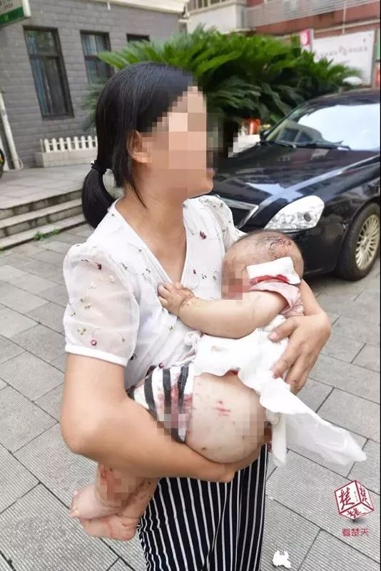 遇到恶狗咬小狗咋办,遇到恶犬追咬如何自救