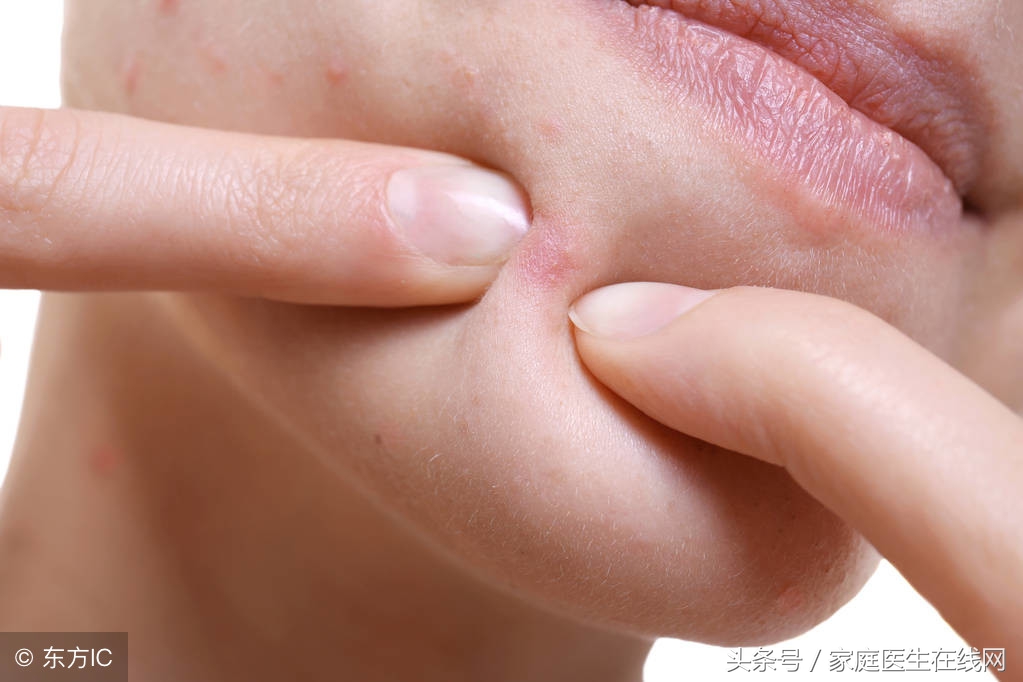 疮疡是由哪些因素引起的呢,疮疡前期的治疗方法