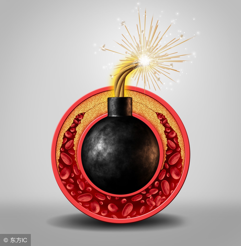 身体里胆固醇含量过高的表现,什么可以导致血液胆固醇升高