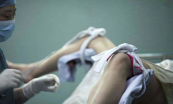 人流手术的前一天晚上可以塞药吗,人流手术的前后流程