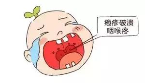 孩子发烧父母立马就能察觉,家长发烧孩子都什么反应