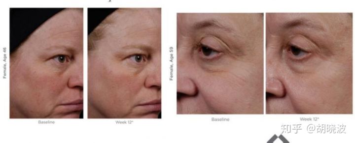 倩碧a醇含量,倩碧鲜活a醇