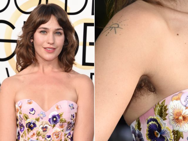 腋下不干净有干皮,腋下不干净会导致狐臭吗