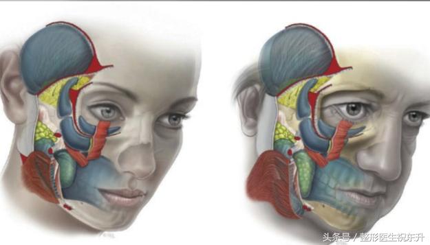 浅谈面部五层提升为什么能更好的解决面部松弛下垂