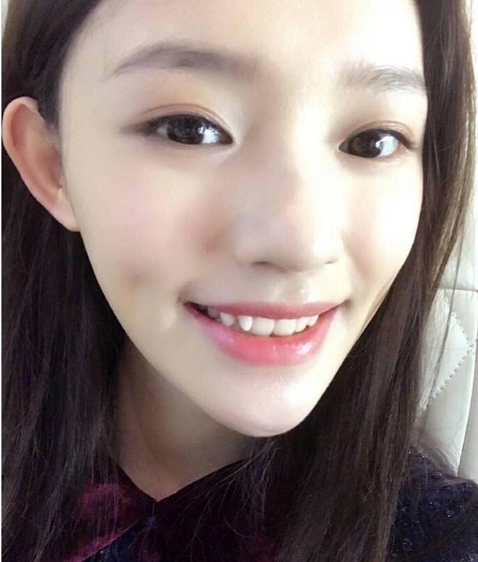 明星颜值变化杨幂,哪些明星整牙后变化巨大