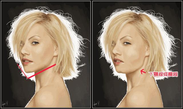 线雕悬吊术，逆生长就是这么随意！