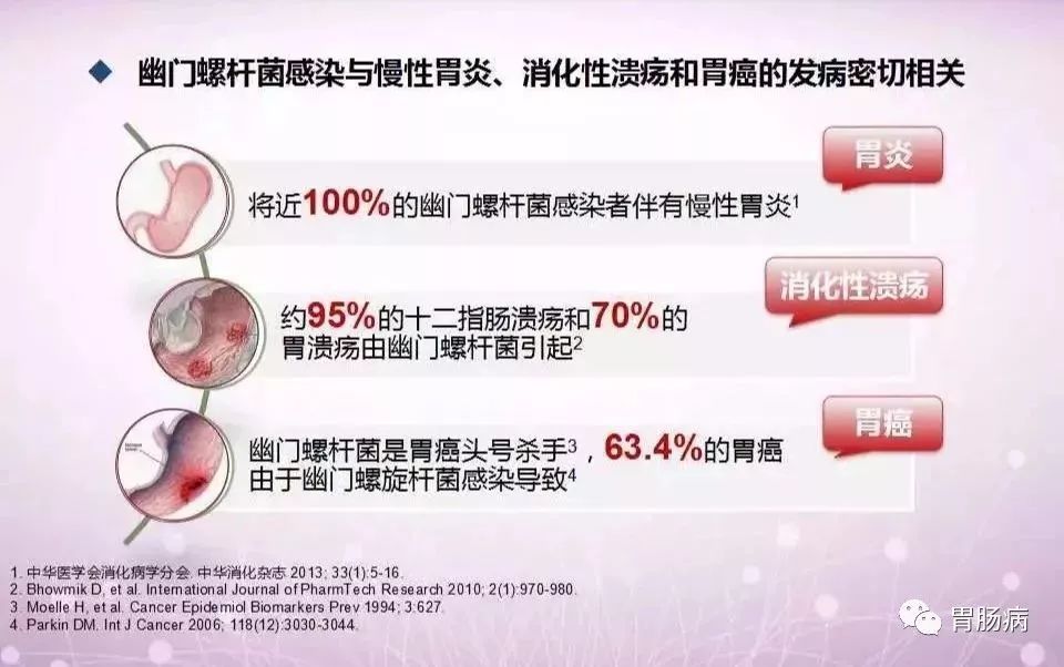 幽门螺杆菌HP什么意思,hp幽门螺杆菌的症状