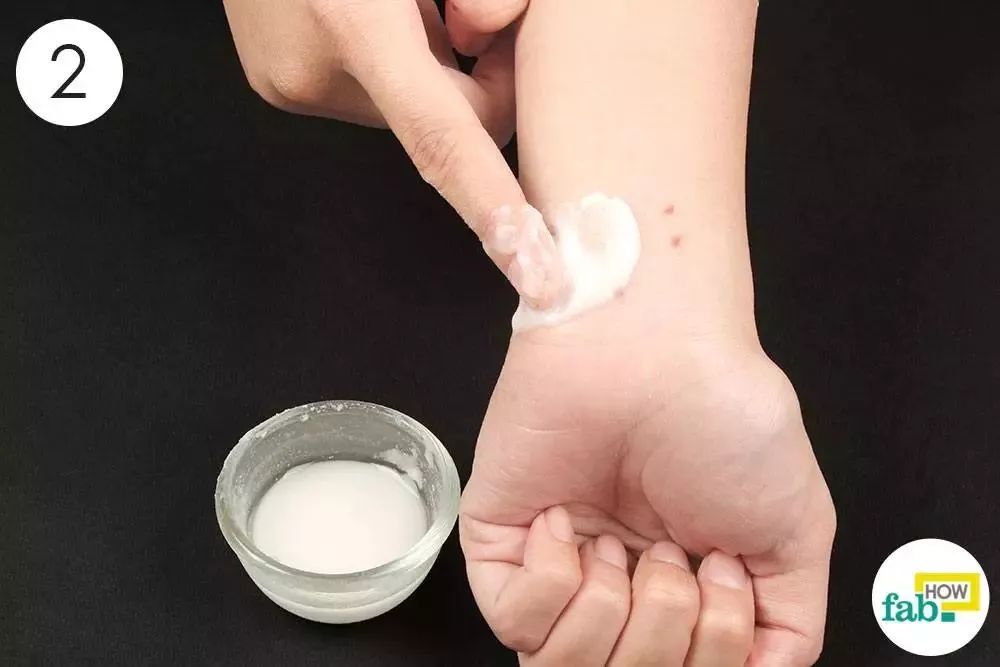 蚊子咬了涂什么药膏止痒,蚊子咬了什么药膏止痒效果好