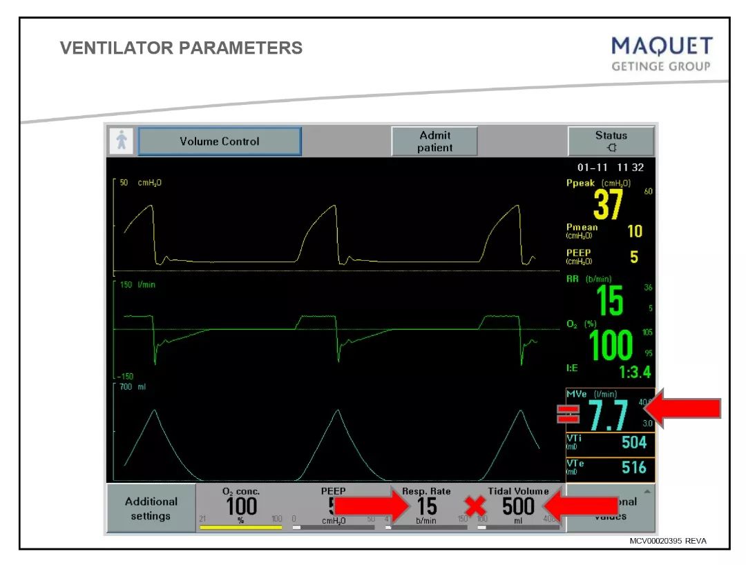 呼吸机模式和参数设置及临床意义,院前呼吸机模式及参数设置