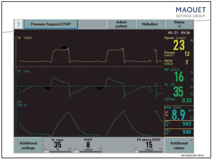 呼吸机模式和参数设置及临床意义,院前呼吸机模式及参数设置