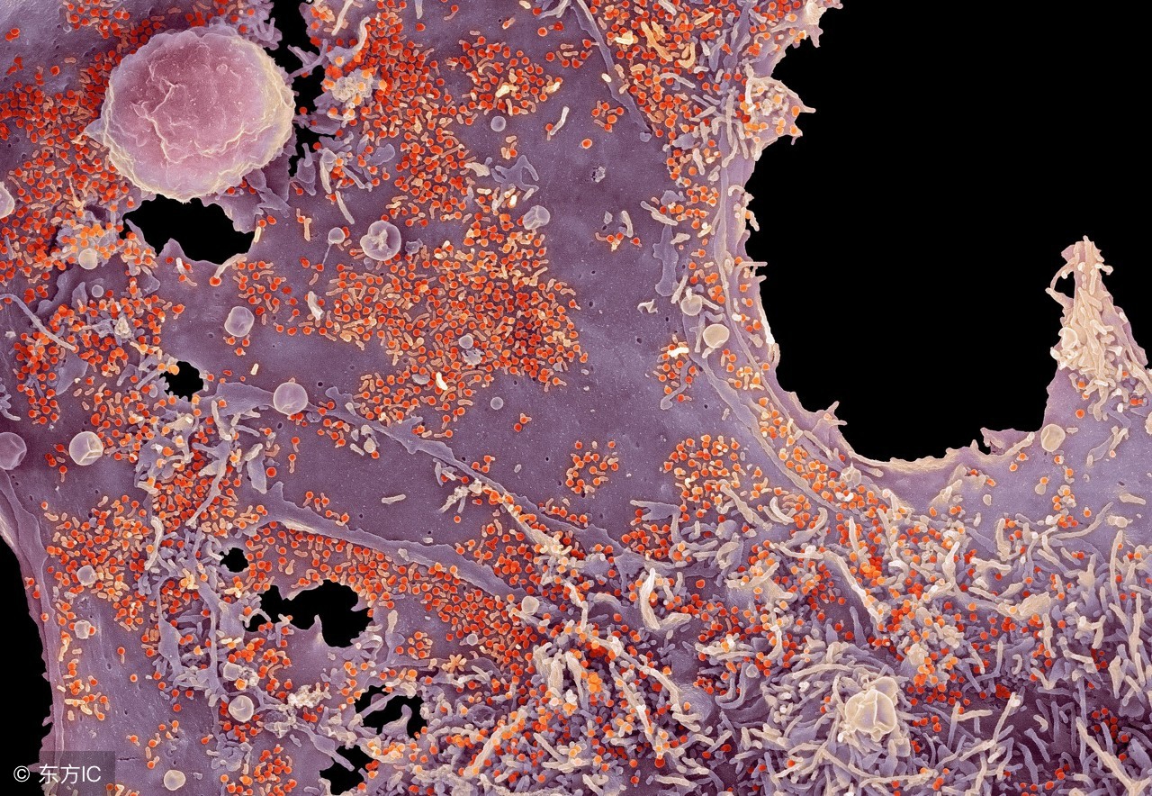 预防单纯疱疹病毒感染的饮食宜忌有哪些呢？