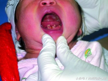 新生宝宝,新生儿第一次来例假前有什么症状