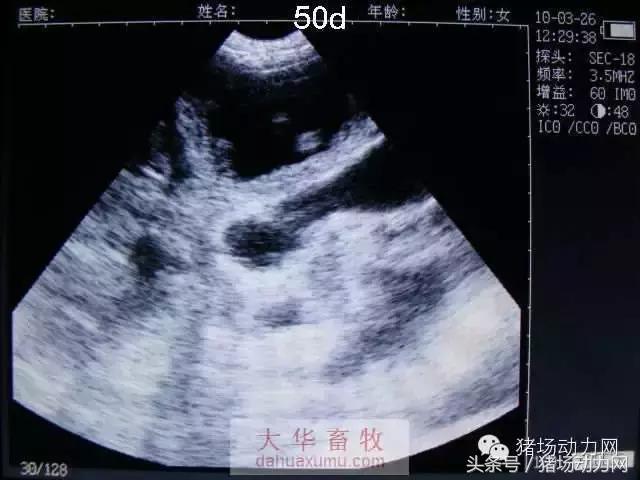 母猪b超图像如何看,怀孕100天的母猪b超影像