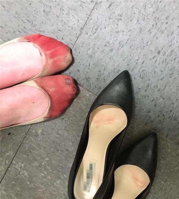 凉鞋掉色染脚会对身体有害吗,买的凉鞋掉色