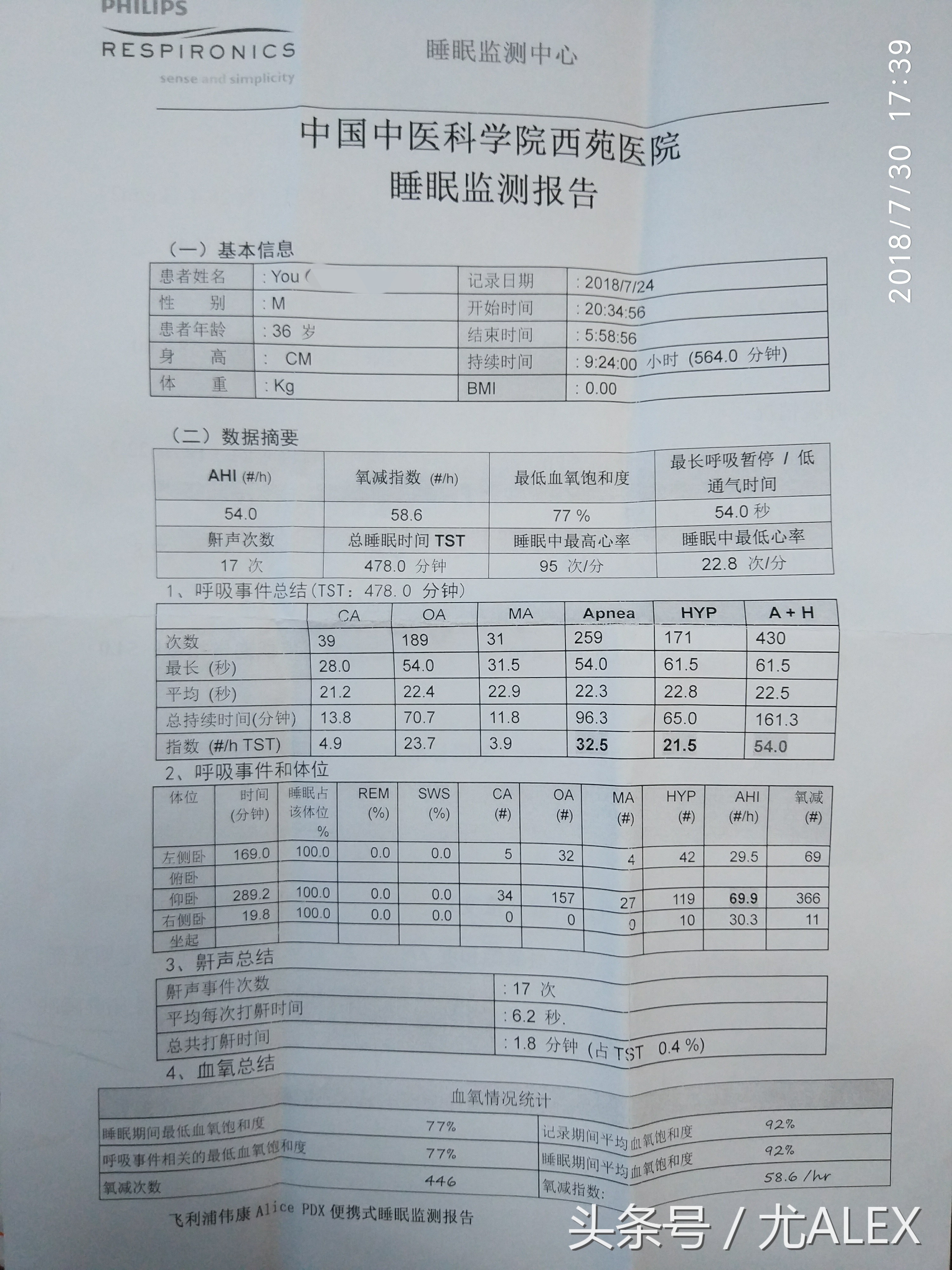 使用呼吸机真实感受,我怕死免费阅读